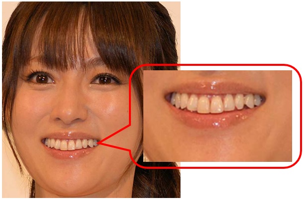 深田恭子