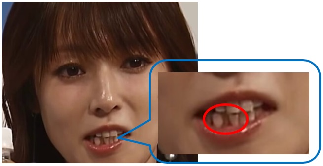 深田恭子